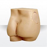 엉덩이근육주사모형