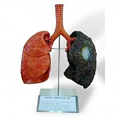흡연자와 비흡연자의 폐