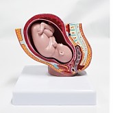 (미니)성숙아와 임신골반